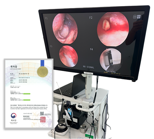 내시경 장비와 특허증 이미지